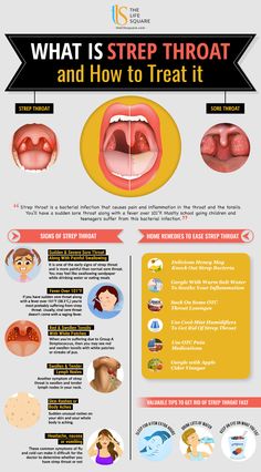 Signs Of Strep Throat, Sore Throat Remedies For Adults, Strep Throat Remedies, Throat Remedies, Sore Throat Remedies, Dry Cough Remedies, Throat Pain, Throat Infection, Sick Remedies