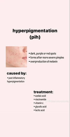 #hyperpigmentation #skincare #niacinamide #vitaminc Vitamins For Hyperpigmentation, Post Inflammatory Hyperpigmentation Acne, Aesthetic Dermatology, Post Inflammatory Hyperpigmentation, Skin Therapist, Skin Care Basics