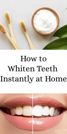 Best product for white teeth within 5 minutes | how to whiten teeth instantly at home

Simple Way to Naturally Whiten Your Teeth Instantly at Home Without Any Chemical Product. A smile is the best accessory that brings n... Quick Teeth Whitening Diy, Natural Ways To Whiten Teeth, How To Bleach Your Teeth At Home, Home Made Teeth Whitener, Best Way To Whiten Teeth At Home, Home Made Teeth Whitening, How Whiten Your Teeth, How To Brighten Teeth, Natural Ways To Whiten Teeth At Home