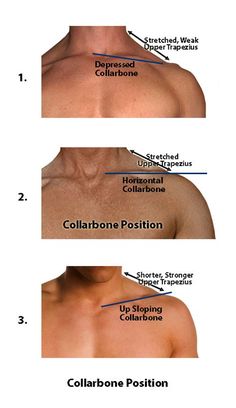 Overcoming Chronic Neck Pain: Postural Causes and A Unique Exercise Fix Neck Exercises, Posture Exercises, Staying Motivated, Massage Benefits, Neck And Back Pain, Healthy Liver