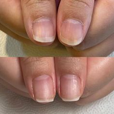 Nail Growth Tips, Nail Paint Shades, Gel Nails French, Acrylic Nail Shapes, Cute Toe Nails, Nail Care Routine, Blush Nails, Pretty Gel Nails, Soft Nails