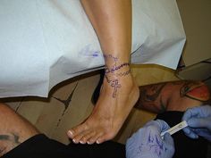 a person with a tattoo on their foot getting an injection from another person's leg