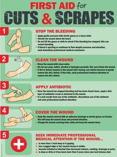 First Aid Posters | Safety Poster Shop Message For Brother, Survival Skills Emergency Preparedness, Spanish Posters, Nursing Mnemonics