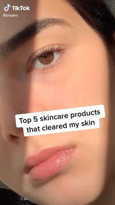 skin care Clear Skin Fast Clear Skin Tips How To Clear Skin Good Skin Tips Skin Care Routine Ste Obličejové Masky, Clear Skin Fast, Fungal Acne, Haut Routine, Clear Skin Face, Types Of Acne, Clear Skin Tips, Healthy Skin Tips, Facial Skin Care Routine