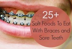 Mouth sores, tender gums, and a sore throat can make eating uncomfortable. And after getting braces, your teeth will be sore which makes chewing and swallowing difficult. One the day you have your braces put on, it is best to avoiding some types of foods which can damage or break your braces including hard, sticky, crunchy and … Braces Recipes, Madison Paige