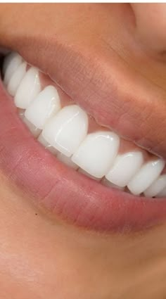 Teeth Aesthetic, Pretty Teeth, Crest 3d White, Whiter Teeth, Whiten Your Teeth, Perfect Teeth, روتين العناية بالبشرة, Whitening Kit, Teeth Whitening Kit