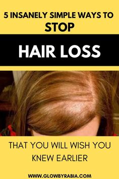 Hair loss and hair thinning can be very upsetting and can take a toll on our self-confidence. Check out this pharmacist guide to what you can do today to stop hair from thinning and how to boost hair growth from home. thinning hair| hair thinning women| thinning hair remedies| how to stop hair from falling out| how to stop hair thinning| hair growth| hair growth tips| hair growth faster Thinning Hair Remedies, Boost Hair Growth, Regrow Hair, Hair Healthy, Hair Growth Faster