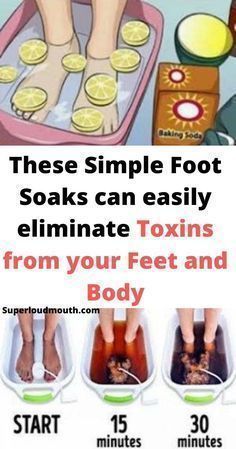 Foot Detox Soak, Detox Your Body, Natural Health Remedies, Health Remedies