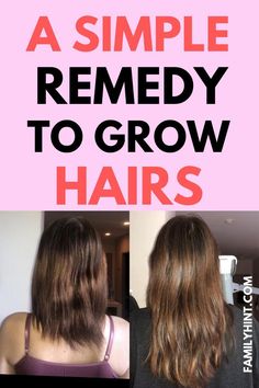 Ways To Grow Your Hair, Help Hair Grow Faster, Fast Natural Hair Growth, Ways To Grow Hair, Growing Your Hair, Grow Your Hair Faster, Regrow Hair Naturally, Longer Hair Faster, Help Hair Grow