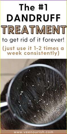 Tired of dandruff ruining your hair days? Discover the top 7 dandruff treatments that actually work to eliminate flakes and itchy scalp for good. Whether you're dealing with dry scalp or stubborn dandruff, these natural dandruff remedies and anti-dandruff shampoos will restore your scalp’s health and give you the confidence to flaunt your hair. Learn how to prevent dandruff, promote hair growth, and maintain a healthy scalp with these powerful hair care tips! Itchy Dry Scalp Remedy, How To Prevent Dandruff, Best Shampoo For Dandruff, Itchy Scalp Remedy, Natural Dandruff Remedy, Dandruff Solutions, How To Treat Dandruff, Home Remedies For Dandruff, Dandruff Remedy