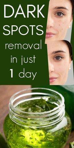 I Got Shocked With The Results Of This Magical Remedy, It Removed Dark Spot In 1 Day #darkspots #natural #diyskin #beautytipsforskin #aloevera #vitaminE Dark Spots Removal, Brown Age Spots, Brown Spots On Skin, Revision Skincare, Dark Spots On Face, Brown Spots Removal, Brown Spots On Face, Dark Spots On Skin, Skin Spots