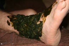 I used comfrey to help my husband's broken ankle heal in record time. Here's how to make a comfrey poultice for broken bones and how to apply it. Illustrated guide. Heal Broken Bones, Homemade Remedies, Bone Health, Medicinal Herbs, Medicinal Plants, Natural Medicine, Natural Living