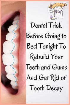 Natural Cavity Remedy, Tooth Ache Relief, Holistic Dentistry, Natural Mouthwash, Before Going To Bed