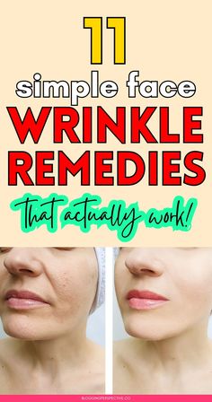 Ready to say goodbye to fine lines? These 11 diy wrinkles remedies will help you prevent wrinkles and keep your skin looking fresh! From home remedies for wrinkles to oils and massages, we’ve got all the wrinkle remedies face tricks you need. Check out the blog for the best anti aging tips and maintain your wrinkles skin care routine effortlessly! Best Anti Wrinkle Products, Natural Wrinkle Remedies The Face, Face Taping For Wrinkles, Wrinkle Remedies Face, 11 Wrinkles, Diy Wrinkle Cream Recipes, Wrinkles Around Mouth, Facial Wrinkles Remover, Upper Lip Wrinkles