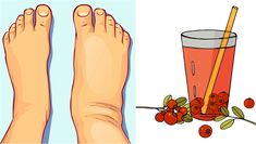 Swollen Hands, Home Remedy For Headache, Swollen Ankles, Swollen Legs, Poor Circulation