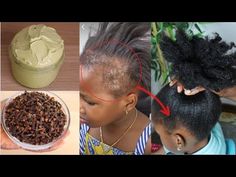 Remedy To Grow Hair Fast, How To Treat Natural Hair, How To Treat Your Hair, Hair Edges Growth Tips, How To Grow Back Edges, How To Grow Edges Back Fast Naturally, How To Take Care Of Natural Hair, How To Grow Your Natural Hair, How To Grow Edges Back Fast