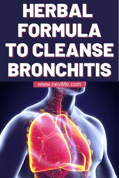 Find the perfect handmade gift, vintage & on-trend clothes, unique jewelry, and more… lots more. Natural Bronchitis Remedies, Symptoms Of Bronchitis, Natural Remedies For Bronchitis, Best Cough Remedy, Toddler Cough Remedies, Cold And Cough Remedies, Cold Medicine, Healthy School