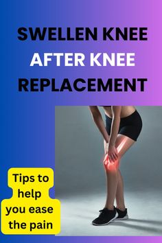 You have recently undergone a total knee replacement surgery, and you are concerned or curious about the swelling you are experiencing. you want to know how long it will last and what you can do to reduce it. Knee Replacement Surgery Videos Total, Full Knee Replacement, Knee Surgery Recovery, Partial Knee Replacement, Swollen Knee