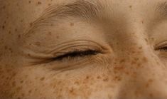 a woman's eyes with freckles on her face and the bottom part of her forehead