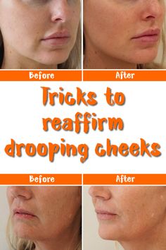 Drooping cheeks is a problem that comes along with aging, and it is well understood that it is frustrating but you should stop buying non efficient an...   #cheeks #droopingskin # #skin Droopy Cheeks, Face Excercise, Obličejové Masky, Double Menton, Natural Hair Mask, Facial Exercises, Face Yoga, Face Scrub