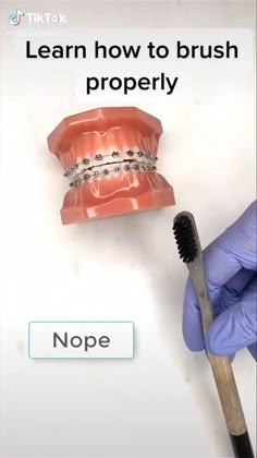 tik tok video of how to properly brush with braces How To Brush Your Teeth With Braces, Brown Braces, White Braces, Straighten Teeth, Braces Care, After Braces, Ceramic Braces, Braces Tips, Getting Braces