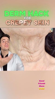 Crepey Neck Skin Remedies Diy, Crepe Neck Skin Remedy, Crepey Skin Remedies Diy, Wrinkly Neck, Crepey Neck, Crepy Skin, Reduce Neck Wrinkles, Loose Neck Skin, Skin Tags On Face