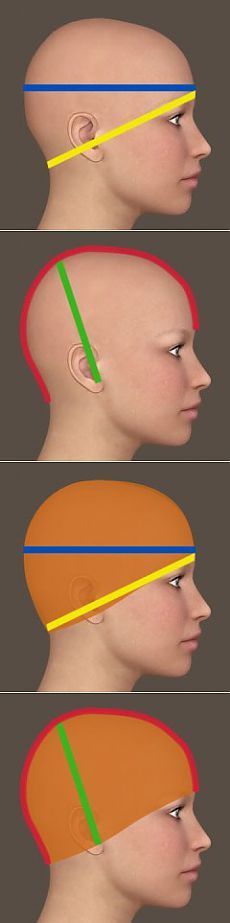 three different views of the head and neck of a person with multiple colored lines on it