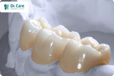 Răng sứ Zirconia là gì? Ưu điểm, hạn chế và giá cả | Dr. Care