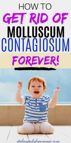 Molluscum Contagiosum, Pregnancy Side Effects, Good Skincare, Cold Home Remedies, Childrens Health, Skin Diseases