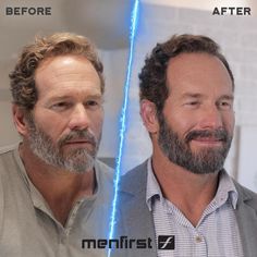 Add more pepper to your salt with Menfirst’s Gradual Gray Darkening Beard Wash. Specially formulated to target white or light gray hair on men’s beards, this beard wash acts like a shampoo for your beard and will leave your facial hair darker, fuller and just a little bit softer. After 4 weeks you’ll notice a significantly darker beard and years’ younger look on your face. Achieve natural-looking darker facial hair using our Gradual Gray Beard Wash. Here at Menfirst, we have created what we call Grey Hair Beard, Beard Shampoo, Medium Hair Color, Mens Shampoo, Grey Beards, Beard Kit, Covering Gray Hair, Beard Wash, Men Hair Color