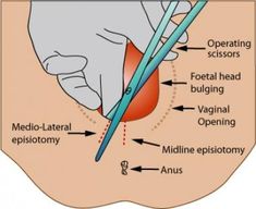 an image of a diagram of the inside of a person's body