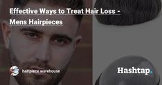 Effective Ways to Treat Hair Loss - Mens Hairpieces How To Grow Natural Hair, Hair Due, Best Wigs, Asian Hair, Professional Hair, Heat Styling Products, Professional Hairstyles