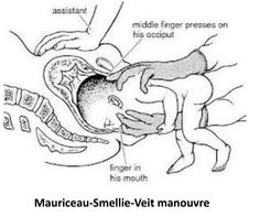 an image of the inside of a baby's stomach