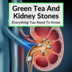 I was very wrong in my thinking about green tea and kidney stones. That is because I read an article many years ago that claimed that drinking tea can make... Parsley Tea For Kidneys, Parsley Tea, Tea Guide, Low Oxalate, Tea Supplies, Green Tea Benefits, Kidney Health, Oolong Tea, Green Tea Extract