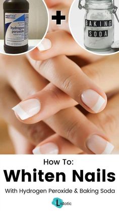 Learn how to whiten your nails with just hydrogen peroxide and baking soda! If you have stubborn stains on your nails that refuse to go away, then this simple life hack may be what you're looking for. Click on the pin for the full instructions and more nail whitening methods over on Listotic! #lifehack #manicure How To Whiten Nails, Baking Soda Nails, Make Nails White, Stained Nails, Nail Polish Stain, Nail Whitening, Baking Soda Uses, Baking Soda Shampoo, Nail Fungus