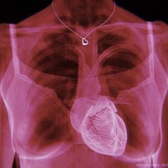 an x - ray image shows the chest and heart in red light, with no visible organs