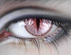 an eye with blood on the iris and part of it's left eye showing