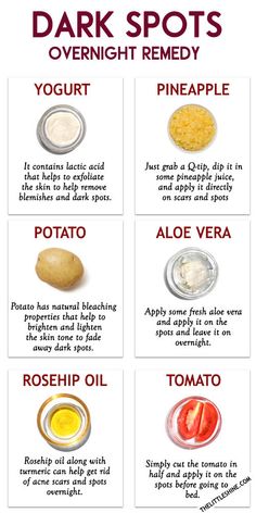 How To Clear Dark Spots On Face Overnight, Skin Care For Sunspots, Dark Spot On Face Remedies, Homemade Skin Care For Dark Spots, Dark Spots On Back From Acne, Sunspots On Face Remedies, Diy For Dark Spots On Face, Dark Spot Corrector Diy, Diy Face Mask For Dark Spots