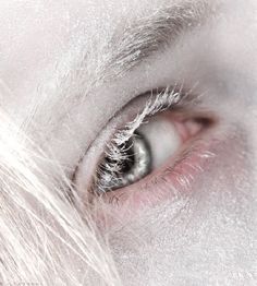 the eye of a person with white hair