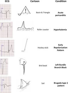 Ecg Reading, Medical Assistant Student, Med Surg Nursing, Medicine Notes