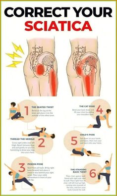 a poster explaining how to correct your sciatica