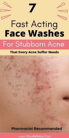 Looking for an acne face wash that actually works? Check this pharmacist Guide on the best acne face wash acne face wash, acne face wash best, acne face wash for sensitive skin, face wash for acne prone skin, face wash for acne, face wash for acne and oily skin, cleanser for acne, acne skincare routine, how to treat acne at home, salicylic acid cleanser, face wash for cystic acne, Face Wash Products