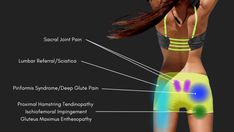 Snapping Hip Syndrome, Hip Flexor Pain, Bursitis Hip, Hip Fracture, Piriformis Syndrome, Diagram Design, Hip Pain, Hip Flexor, Sciatica