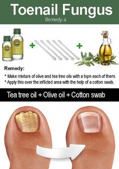 A Short Guide For cryptocurrency Acrylic Nails Natural, Nail Remedies, Toenail Fungus Remedies, Nail Fungus Remedy, Fungal Nail, Toenail Fungus, Nail Fungus, Healthy Nails, Health And Beauty Tips