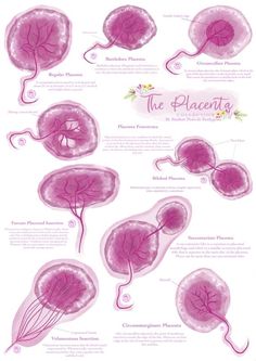 Obstetrics And Gynaecology Art, Midwife Notes, Midwife Birth, Birthing Center, Fetal Monitoring, Heart Sounds