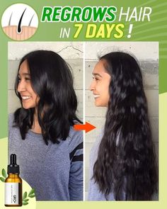 😍Why didn’t I find this Earlier!💃A Head Full of Hair isn’t a Dream!✨ | Herbal Tea Recipes | #didnt Increase Hair Density, Twisted Hair, Hair Growing Tips, Hair Thinning, Regrow Hair, Fuller Hair, Hair Problems, Hair Regrowth, Hair Maintenance