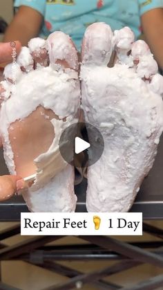 Dry Skin On Feet Removal Diy, How To Get Rid Of Cracked Heels, How To Soften Feet At Home, How To Make Feet Soft And Smooth, Calloused Feet Remedy, Soft Feet Remedy At Home, Soft Hands Tips, Dry Cracked Feet Remedy, Cracked Heel Remedy