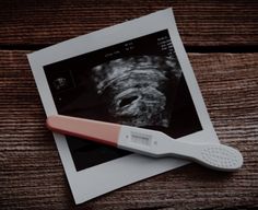 a pink and white toothbrush sitting on top of an old polaroid photo with the image of a dog