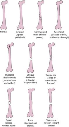 different types of bones and their names