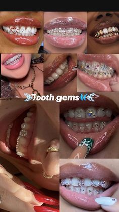 many different pictures of teeth with braces and piercings on them, all in various colors